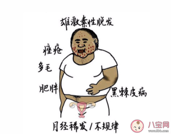 多囊卵巢综合症有多隐蔽 该如何应对多囊卵巢综合症