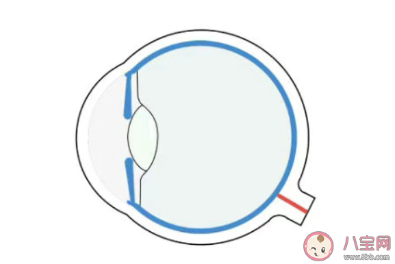 近视手术无法治愈近视 近视能过彻底治好吗