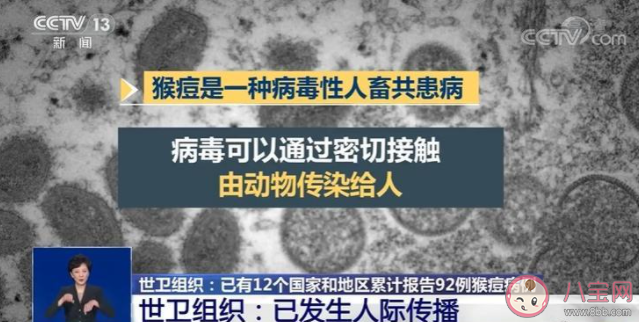 猴痘病毒发生人际传播如何保护自己 怎样防止被猴痘病毒感染