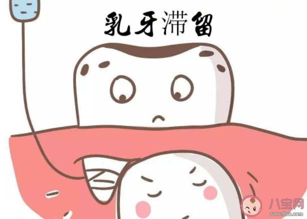 孩子乳牙滞留的原因 乳牙滞留多久就要拔