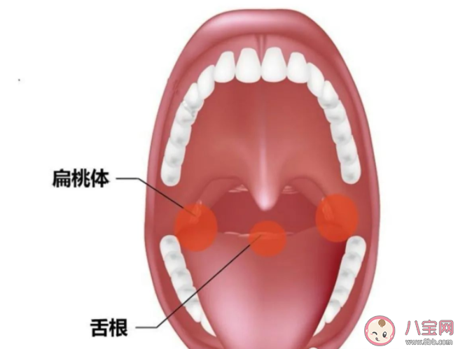 爱发炎的扁桃体到底有啥用 为什么扁桃体爱发炎