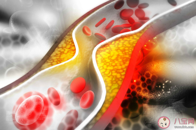 这些血管软化方法不可信 想要血管健康要做好这些事