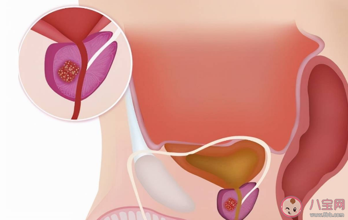 为什么说前列腺是男性的生命腺 排尿超60秒要查前列腺吗