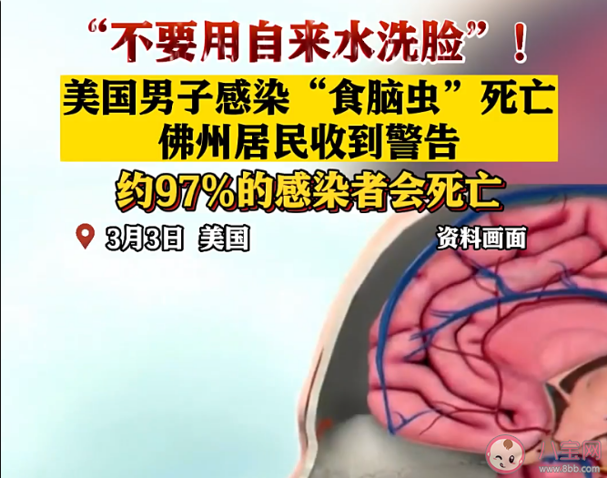 男子用自来水洗脸感染食脑虫死亡是怎么回事 食脑虫通常会出现在哪儿