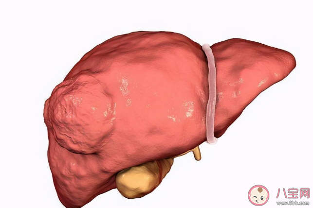 为什么肝癌通常一发现就是晚期 肝癌遗传几率大吗