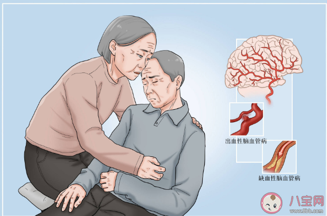 脑中风后需要静养吗 脑卒中患者治疗回家后怎样康复