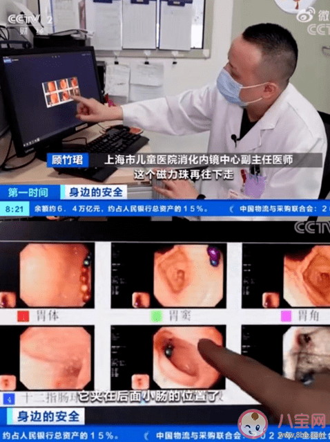 网红磁性笔误吞或有致命风险 使用网红磁性笔要注意些什么