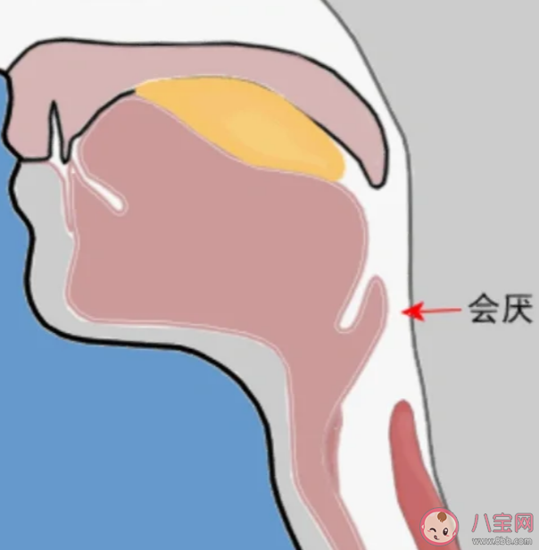 急性会厌炎是什么引起的 急性会厌炎有什么症状