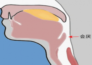急性会厌炎是什么引起的 急性会厌炎有什么症状