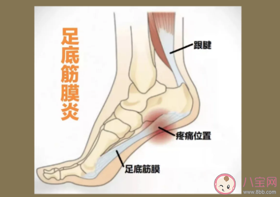 走路脚痛是什么原因 足底筋膜炎如何预防