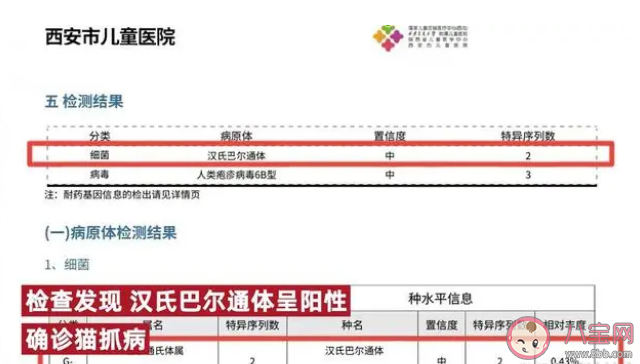 9岁女孩被猫抓伤高烧14天 猫爪病是怎么引起的如何预防