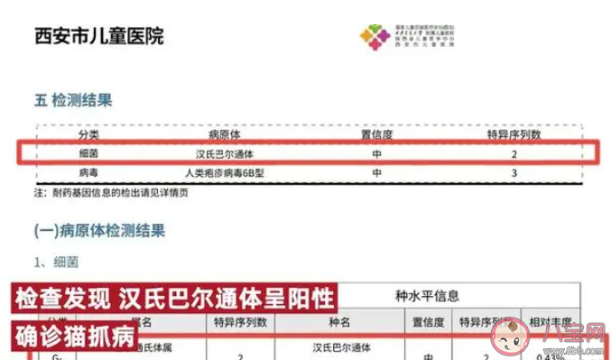 9岁女孩被猫抓伤高烧14天是怎么回事 被猫抓伤了该怎么办