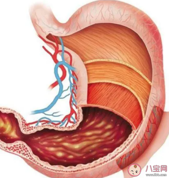 浅表性胃炎严重吗 浅表性胃炎如何自愈