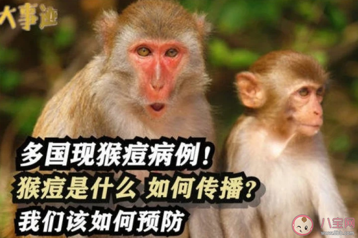 猴痘在中国传播风险如何 如何预防猴痘病毒感染