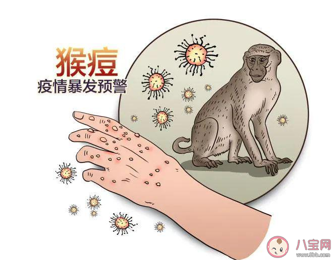 如何避免感染猴痘病毒 猴痘治疗的时间要多久