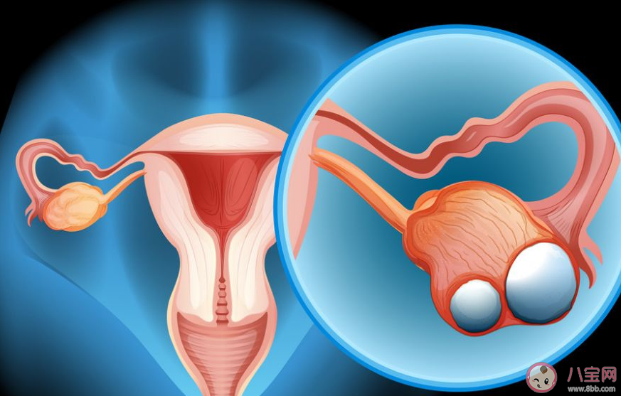 卵巢癌的早期症状有哪些 卵巢癌能被治愈吗