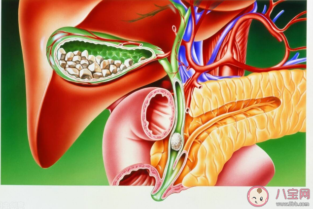 急性胰腺炎的发病率是多少 为什么胡吃海喝会引起急性胰腺炎