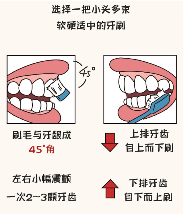 塞牙是牙齿在求救吗 总是塞牙该怎么办