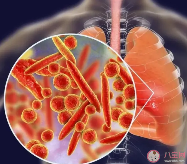 为什么今年支原体传染严重 感染支原体的儿童增加了是什么原因