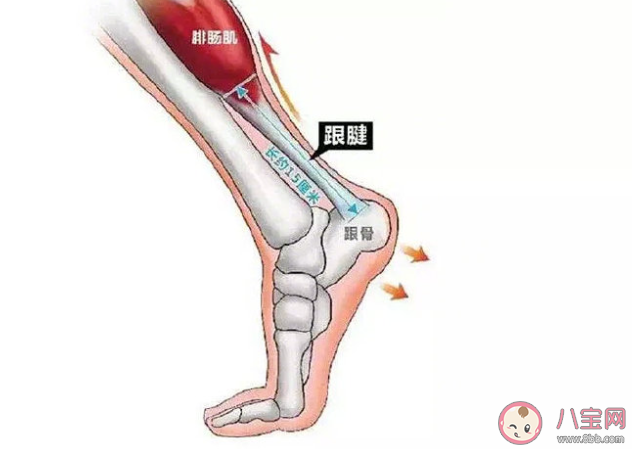 运动时如何预防跟腱损伤 跟腱断裂该怎么办