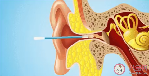 普通人没必要掏耳屎吗 掏耳屎几天一次最好
